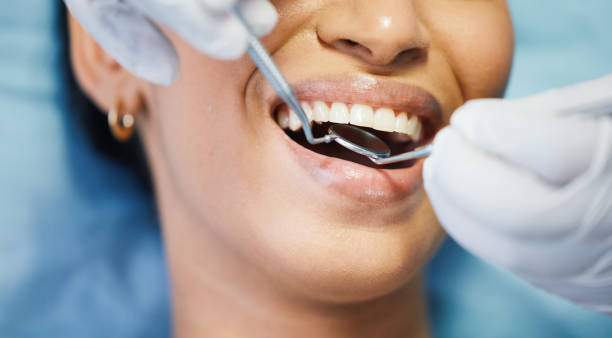 Best Emergency Dentist for Lost Fillings or Crowns in Ocala, FL